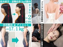 美骨矯正 ステキプロ(SUTEKI pro)