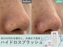 アネラ 新宿店(ANELA)の雰囲気（ハイドロスプラッシュで毛穴汚れ・お肌のくすみ等の悩みを解消！）