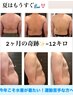 【6月限定夏目前！夏前にリセット】ハーブ×鍼灸で理想のボディへ
