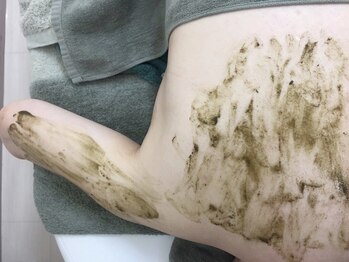 スリジエ ボーテ(cerisierBEAUTE)の写真/ブライダル人気◆引締め/肌質改善*VIO/全身◎黒ずみ/ニキビケア/ザラつきに【BODYハーブピーリング¥29800】