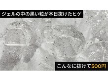 美容脱毛専門サロン エピラージュ 新宿店(Epilage)/爆抜けのヒゲ脱毛