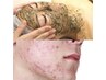  【エステ】REVI陶肌トリートメント+高濃度ビタミン+生酵素+再生因子