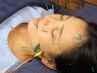 【人気No .1】電気パルス美容鍼(40本前後)＋頭皮鍼ドライヘッド45分¥10450→