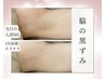 【脇/二の腕/お尻】色素取り◆ヒト幹細胞ハーブピーリング