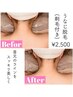 スッキリうなじ脱毛 (剃毛付き) ¥2,500