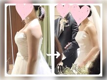 蒼(so)/大幅減量したい方は8~10回お勧め